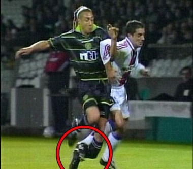 Henrik Larsson broken leg