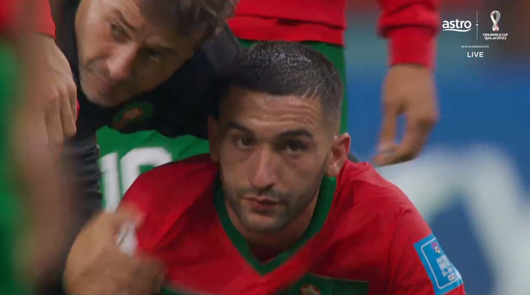 ziyech derma